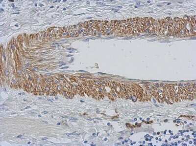 Immunohistochemistry-Paraffin: Carbohydrate Sulfotransferase 15/CHST15 Antibody [NBP2-15896]