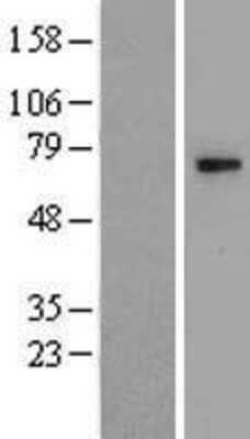 Western Blot: Carbohydrate Sulfotransferase 15/CHST15 Overexpression Lysate [NBL1-10951]