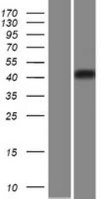 Western Blot: Carbohydrate Sulfotransferase 5/CHST5 Overexpression Lysate [NBP2-06323]