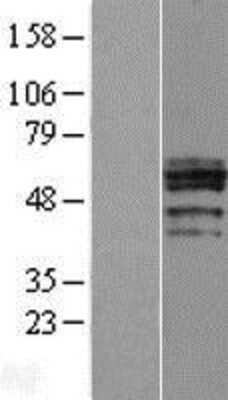 Western Blot: Carbohydrate Sulfotransferase 6/CHST6 Overexpression Lysate [NBL1-09197]