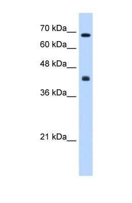 Western Blot: CHST8 Antibody [NBP1-69273]