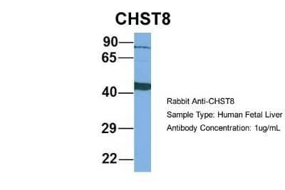 Western Blot: CHST8 Antibody [NBP1-69273]