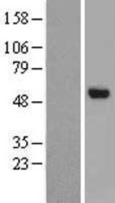 Western Blot: CHST8 Overexpression Lysate [NBP2-09463]