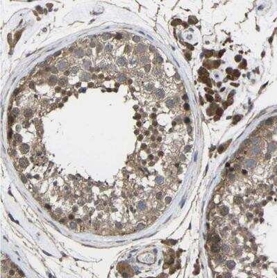 Immunohistochemistry-Paraffin: CHST9 Antibody [NBP1-83395]