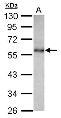 Western Blot: CHST9 Antibody [NBP2-15898]
