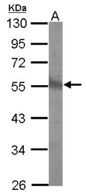 Western Blot: CHST9 Antibody [NBP2-15898]