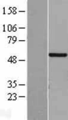 Western Blot: CHST9 Overexpression Lysate [NBL1-09199]