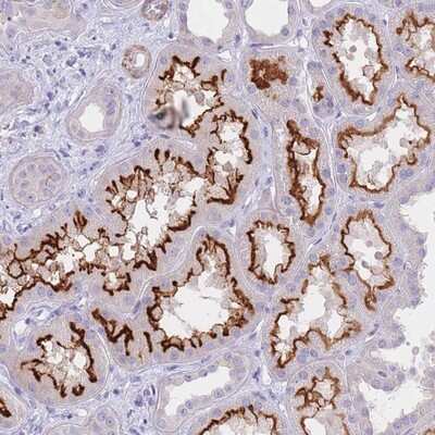 Immunohistochemistry-Paraffin: CHSY1 Antibody [NBP2-13838]