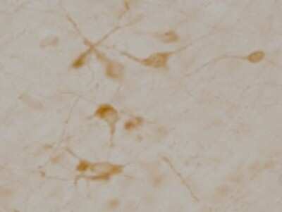 Immunohistochemistry: CHT1 Antibody (62-2E8) [NB110-74570]