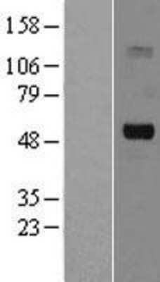 Western Blot: CHT1 Overexpression Lysate [NBL1-16176]