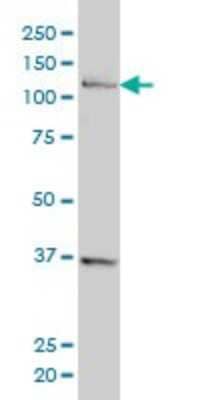 Western Blot: CHTF18 Antibody (1F5) [H00063922-M01]