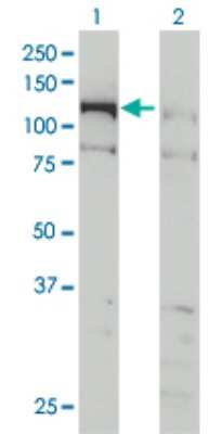 Western Blot: CHTF18 Antibody (1F5) [H00063922-M01]