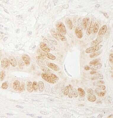 Immunohistochemistry-Paraffin: CHTF18 Antibody [NBP1-03346]