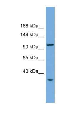 Western Blot: CHTF18 Antibody [NBP1-57605]