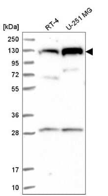 Western Blot: CHTF18 Antibody [NBP2-58935]