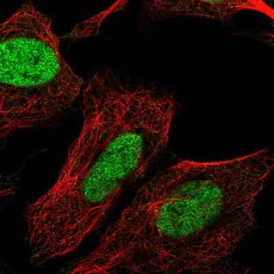 Immunocytochemistry/ Immunofluorescence: CHTF8 Antibody [NBP2-56494]