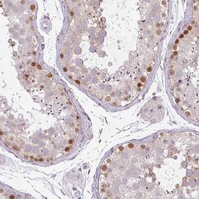 Immunohistochemistry-Paraffin: CHTF8 Antibody [NBP2-30490]