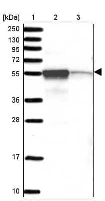 Western Blot: CHTF8 Antibody [NBP2-30490]