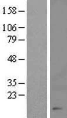 Western Blot: CHTF8 Overexpression Lysate [NBL1-09571]