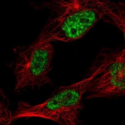 Immunocytochemistry/ Immunofluorescence: CHTOP Antibody [NBP2-55155]