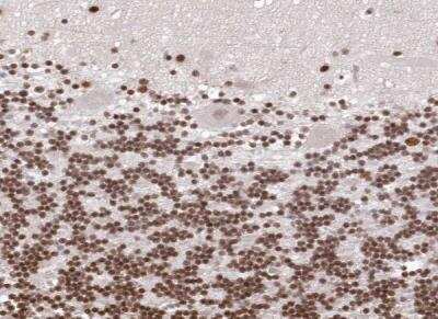 Immunohistochemistry-Paraffin: CHTOP Antibody [NBP1-88085]
