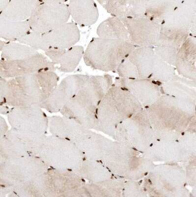 Immunohistochemistry-Paraffin: CHTOP Antibody [NBP1-88085]