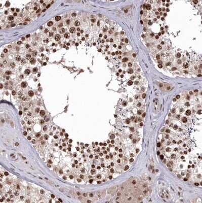 Immunohistochemistry-Paraffin: CHTOP Antibody [NBP1-88085]