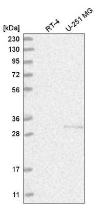 Western Blot: CHTOP Antibody [NBP2-55155]