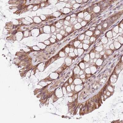 Immunohistochemistry-Paraffin: CHURC1 Antibody [NBP1-94125]