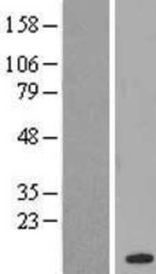 Western Blot: CHURC1 Overexpression Lysate [NBL1-09201]