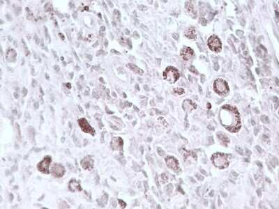 Immunohistochemistry: CHX10 Antibody - C-terminus [NBP3-11891]