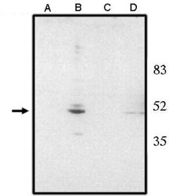 Western Blot: CHX10 AntibodyN-Terminus [NBP3-11892]