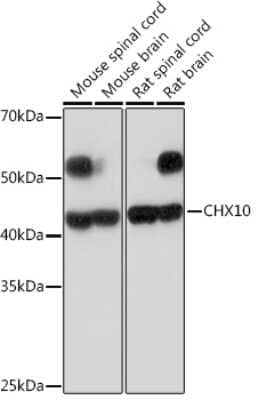 Western Blot: CHX10 Antibody (4Z4R2) [NBP3-15945]