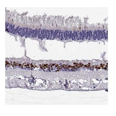 Immunohistochemistry-Paraffin: CHX10 Antibody [NBP1-84476]