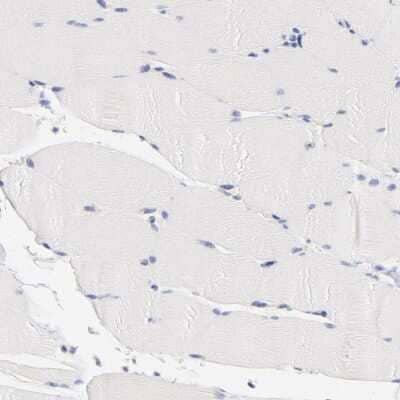 Immunohistochemistry-Paraffin: CHX10 Antibody [NBP1-84476]