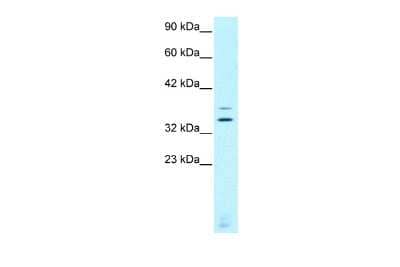 Western Blot: CHX10 Antibody [NBP2-84680]