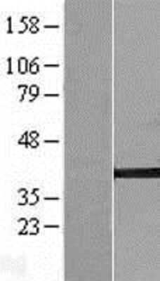 Western Blot: CIAO1 Overexpression Lysate [NBL1-09202]