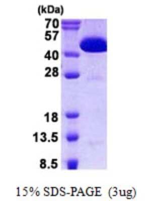 SDS-PAGE: Recombinant Human CIAO1 His Protein [NBP2-22986]