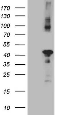 Western Blot: CIAPIN1 Antibody (OTI5A6) [NBP2-46291]