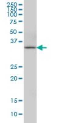 Western Blot: CIAPIN1 Antibody (5G8) [H00057019-M01]