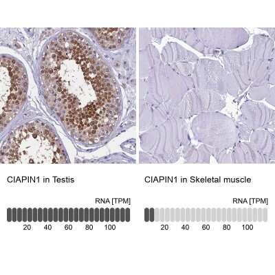 Immunohistochemistry-Paraffin: CIAPIN1 Antibody [NBP1-89097]