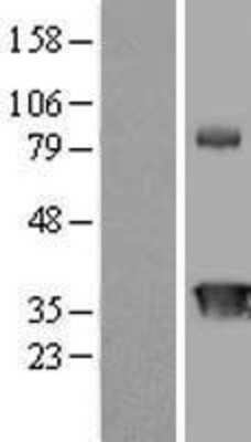 Western Blot: CIAPIN1 Overexpression Lysate [NBL1-09203]