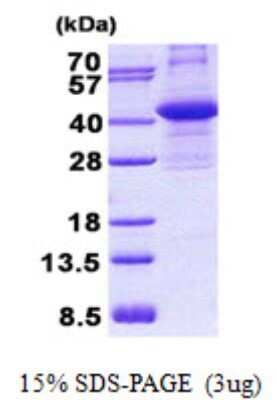 SDS-PAGE: Recombinant Human CIAPIN1 His Protein [NBP2-22984]