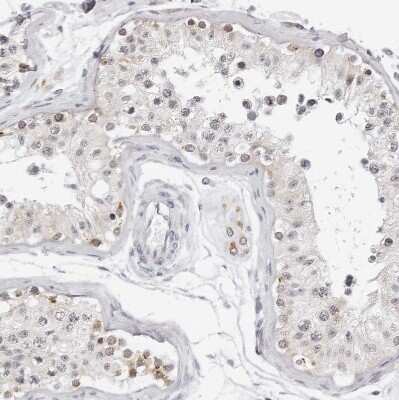 Immunohistochemistry-Paraffin: CIART Antibody [NBP1-88685]