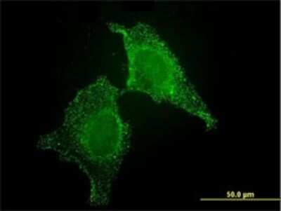 Immunocytochemistry/ Immunofluorescence: CIB1 Antibody (4D2-3A8) [H00010519-M01]