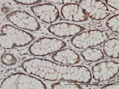 Immunohistochemistry-Paraffin: CIB1 Antibody (4D2-3A8) [H00010519-M01]