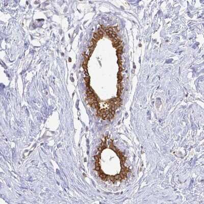 Immunohistochemistry: CIB1 Antibody [NBP2-68646]