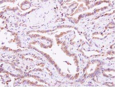 Immunohistochemistry-Paraffin: CIB1 Antibody [NBP1-31298]