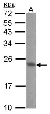 Western Blot: CIB1 Antibody [NBP1-31298]