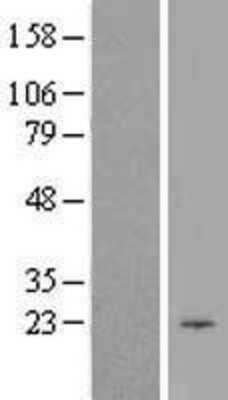 Western Blot: CIB1 Overexpression Lysate [NBL1-09204]